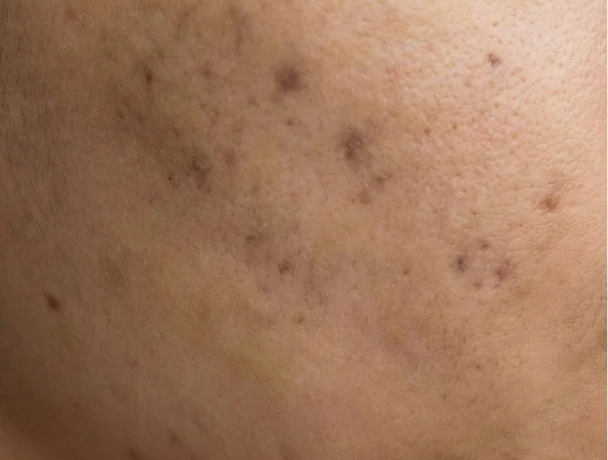 Công dụng PRO-RETINOL 0.6