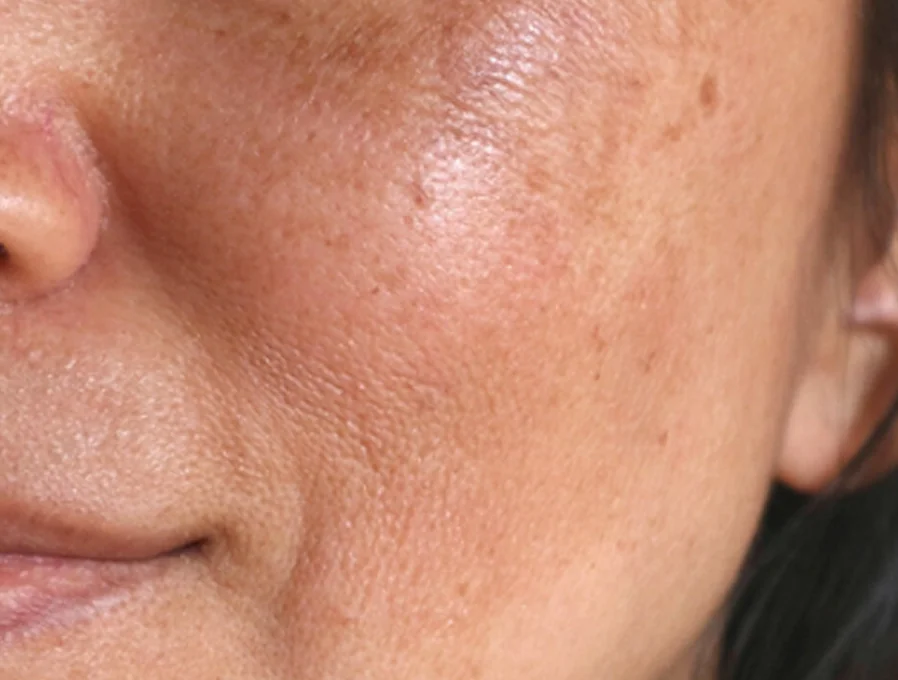 Công dụng PRO-RETINOL 0.6